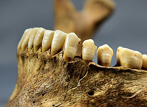 Feine Linien im Zahnschmelz zeigen Stressphasen im Leben der frühmittelalterlichen Menschen an. Foto: Harbeck, SNSB - Staatssammlung für Anthropologie München